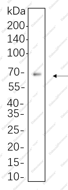 Recombinant AFP Monoclonal Antibody - 1