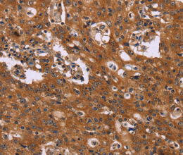 CMTM6 Polyclonal Antibody - 2