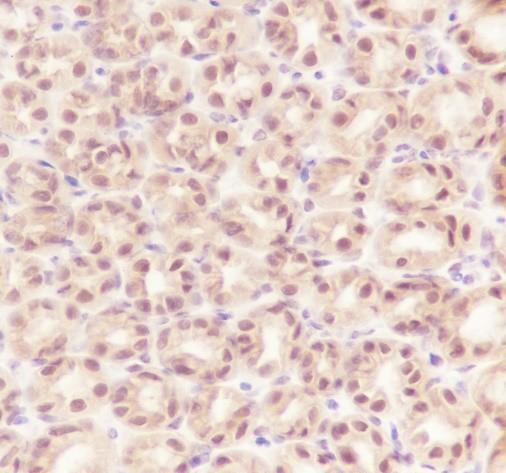 Recombinant RBX1 Monoclonal Antibody - small - 4