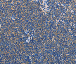 AMY2A Polyclonal Antibody - 2
