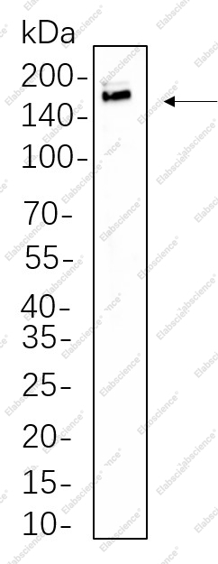 Recombinant IRS-1 Monoclonal Antibody - 1