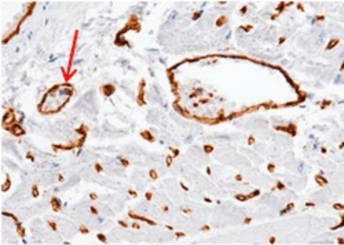 Recombinant ADAM15/MDC15 Monoclonal Antibody - small - 4