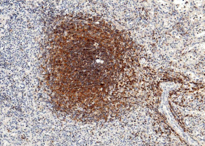 Recombinant IL-16 Monoclonal Antibody - small - 2