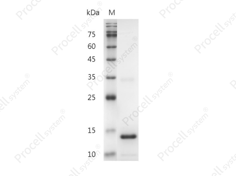 IL-3/MCGF, Human, Recombinant