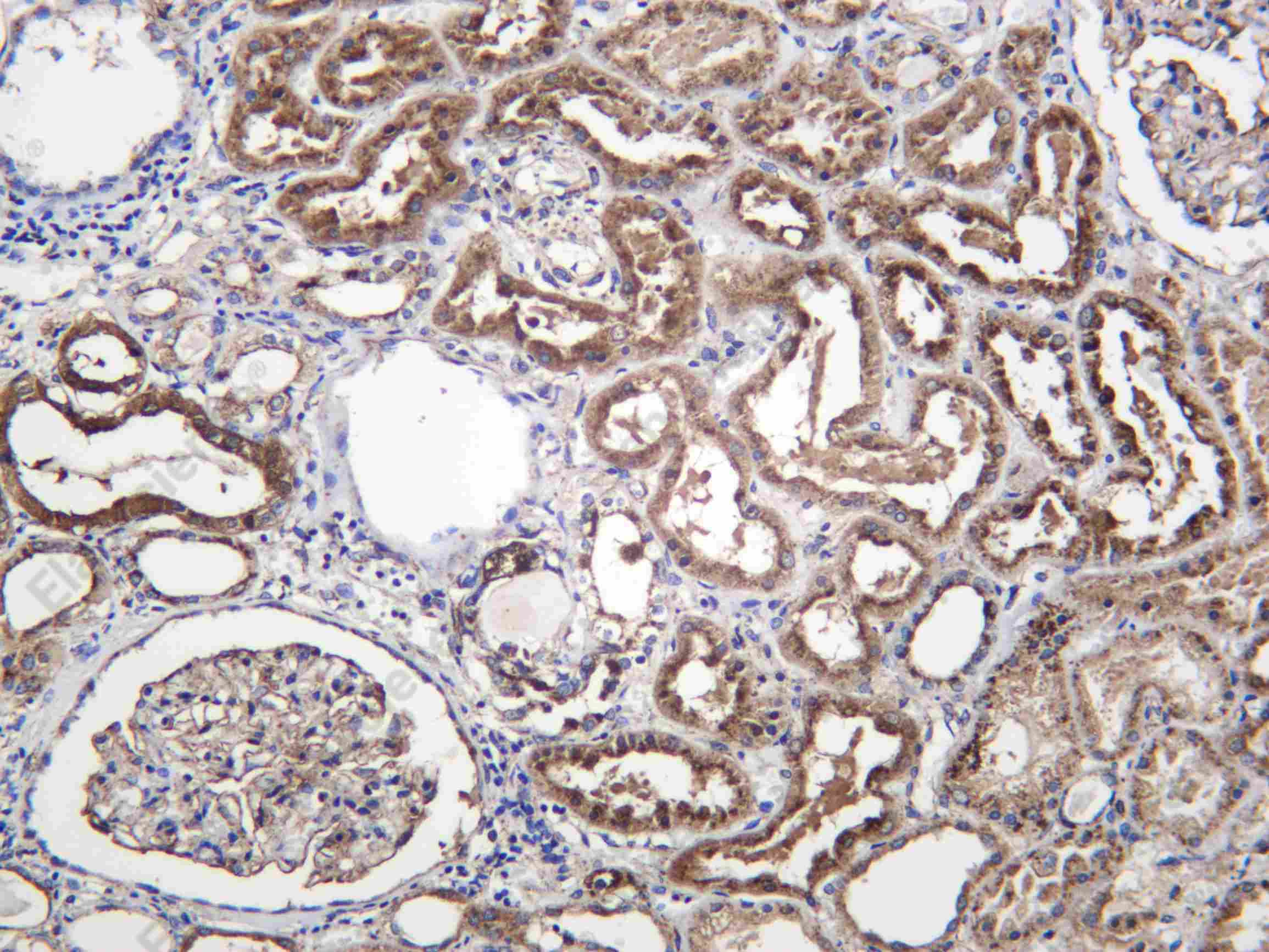 Recombinant SCRB2 Monoclonal Antibody - 1