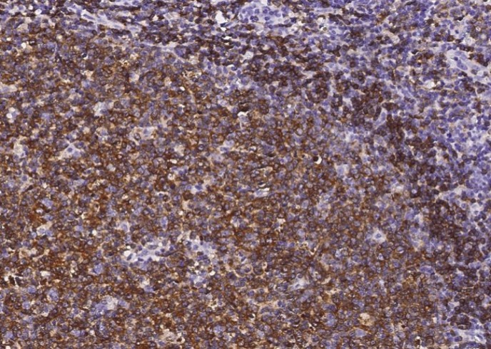 Recombinant CD22 Monoclonal Antibody - small - 2
