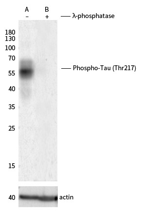 Recombinant Phospho-Tau (Thr217) Monoclonal Antibody-searchlist-1