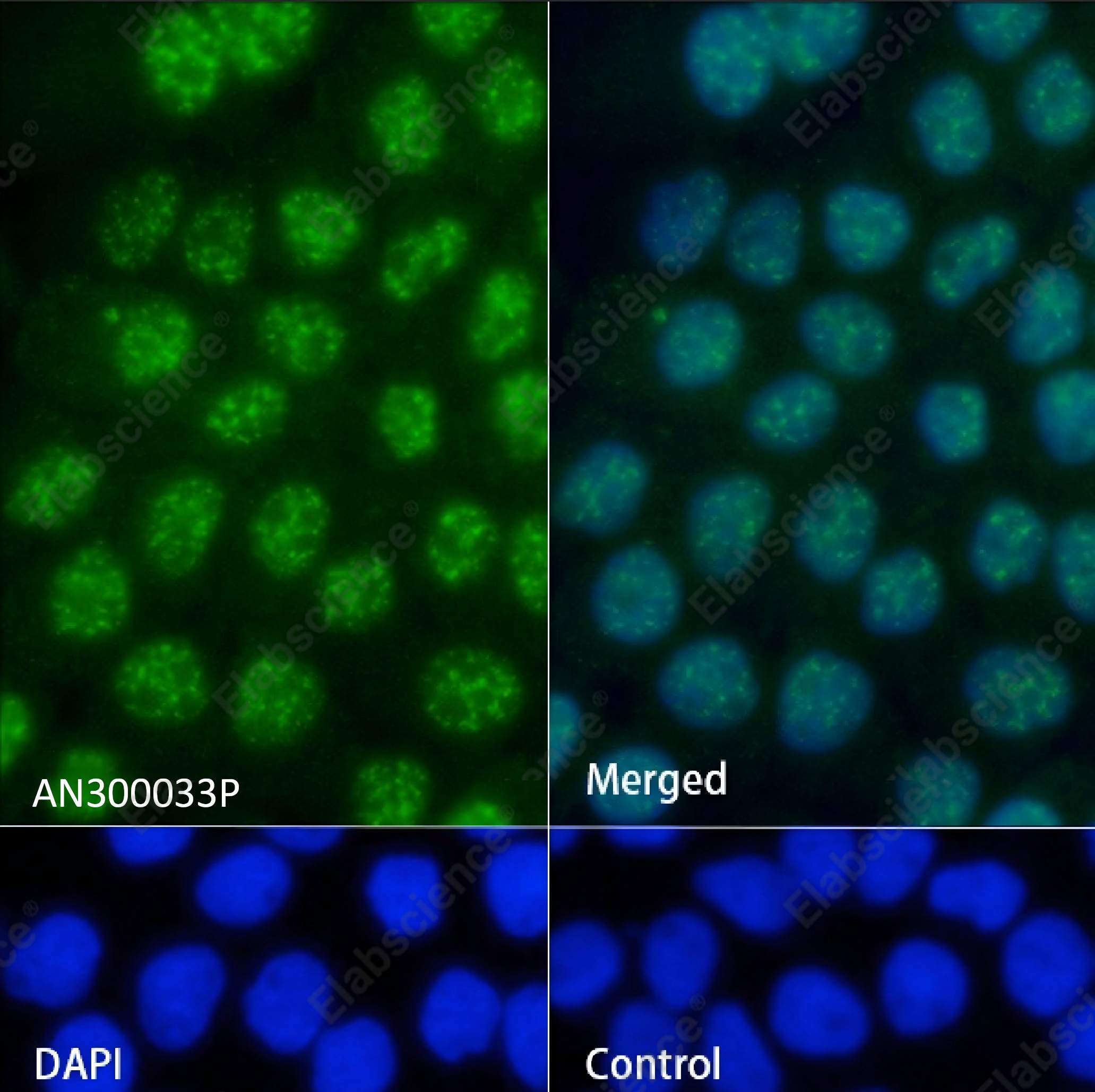 Recombinant Caspase-14/CASP14 Monoclonal Antibody - 3