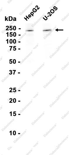 Recombinant SMCHD1 Monoclonal Antibody - 1