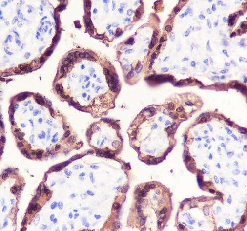 Recombinant HSD17B1 Monoclonal Antibody-searchlist-2