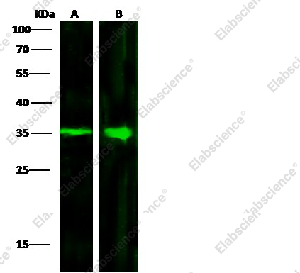 ACBD6 Monoclonal Antibody - 2