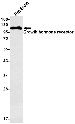 Recombinant Growth Hormone Receptor/GHR/GHBP Monoclonal Antibody - 1
