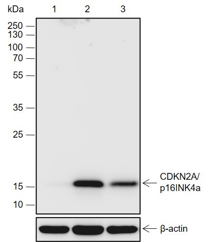 Recombinant CDKN2A/p16INK4a Monoclonal Antibody-searchlist-1