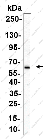 Recombinant Perforin Monoclonal Antibody - 1