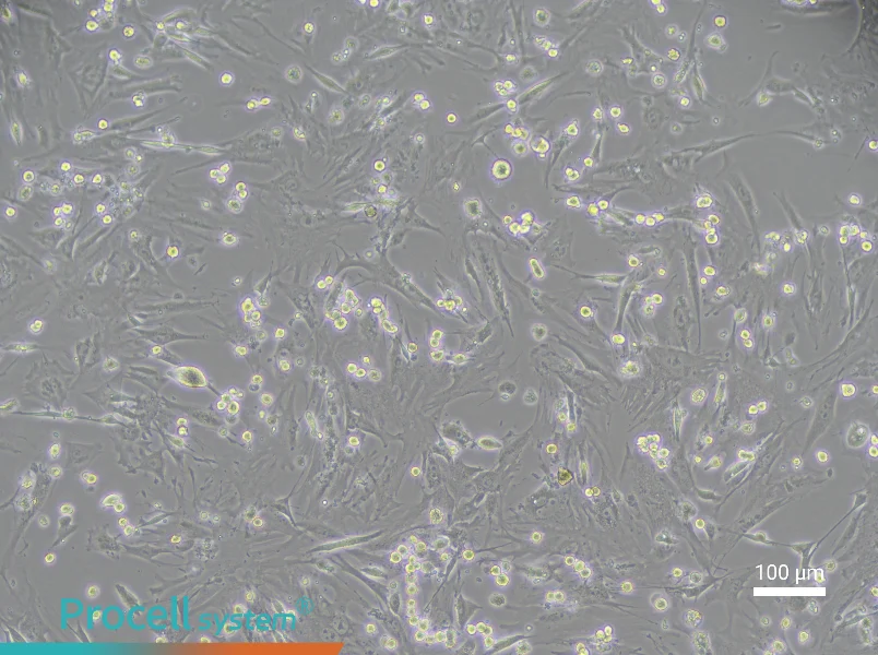 Mouse Vaginal Wall Fibroblast Complete Medium - 2