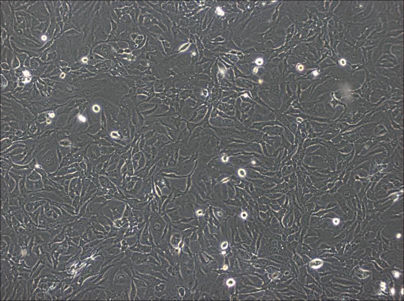 SK-GT-4 Cell Complete Medium - 3