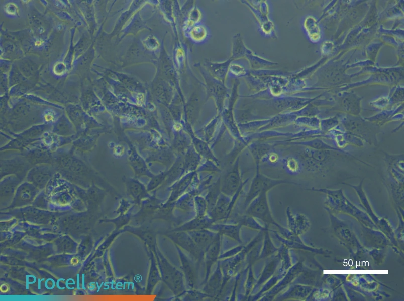 Mouse Hepatic Stellate Cells (Primary cell immortalization) - 6