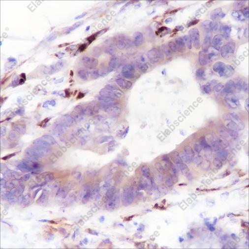 Recombinant Thymidylate Synthase Monoclonal Antibody - 2