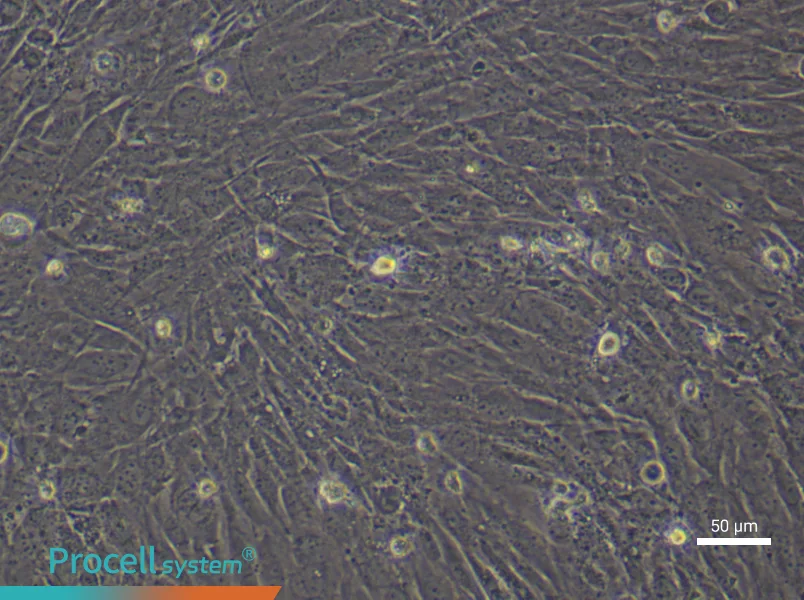 Human Mammary Cancer Fibroblast (Primary cell immortalization) Complete MediumHuman Mammary Cancer Fibroblast (Primary cell immortalization) Complete Medium - 6