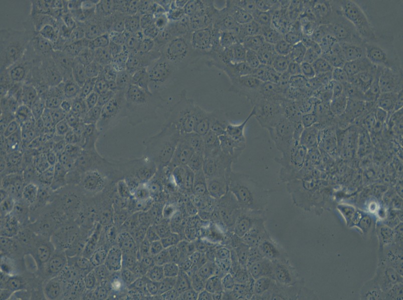 Ca Ski Cell Complete Medium - small - 6