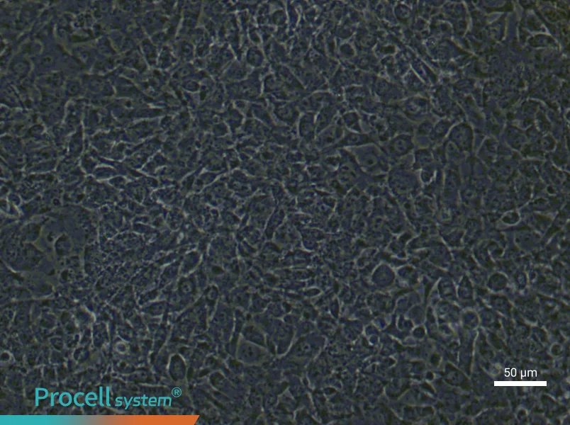 Mouse Pulmonary Microvascular Endothelial Cells (Primary cell immortalization)Mouse Pulmonary Microvascular Endothelial Cells (Primary cell immortalization) - 4