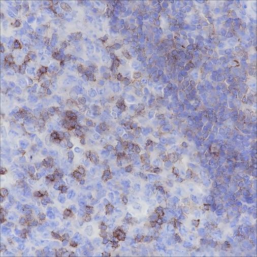 Recombinant CD50/ICAM3 Monoclonal Antibody - 2