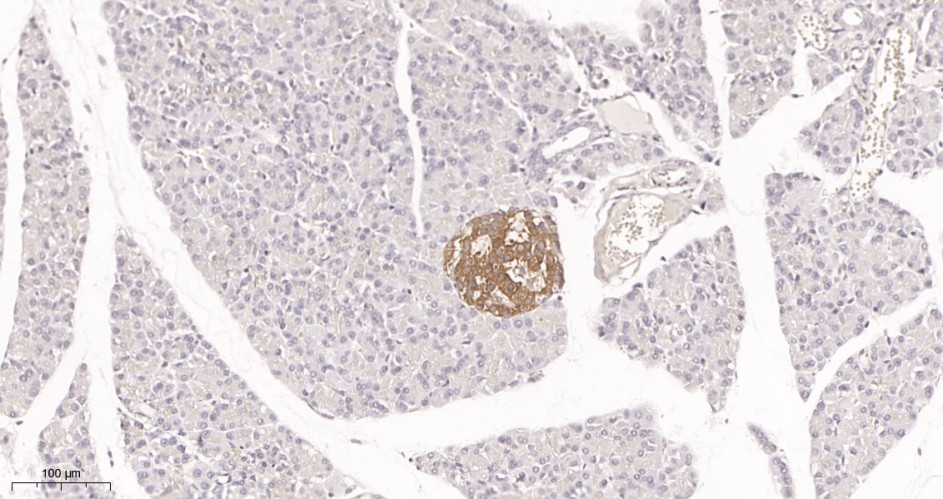 Recombinant DRP1 Monoclonal Antibody - small - 3