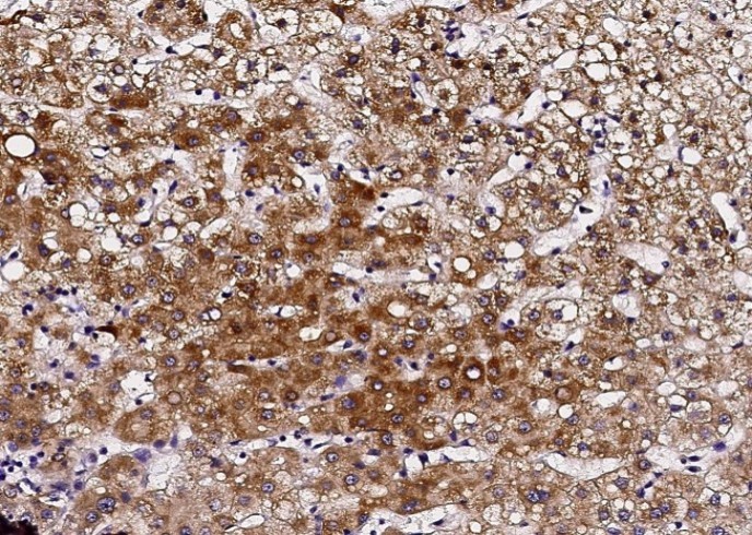 Recombinant PIGR Monoclonal Antibody - small - 2