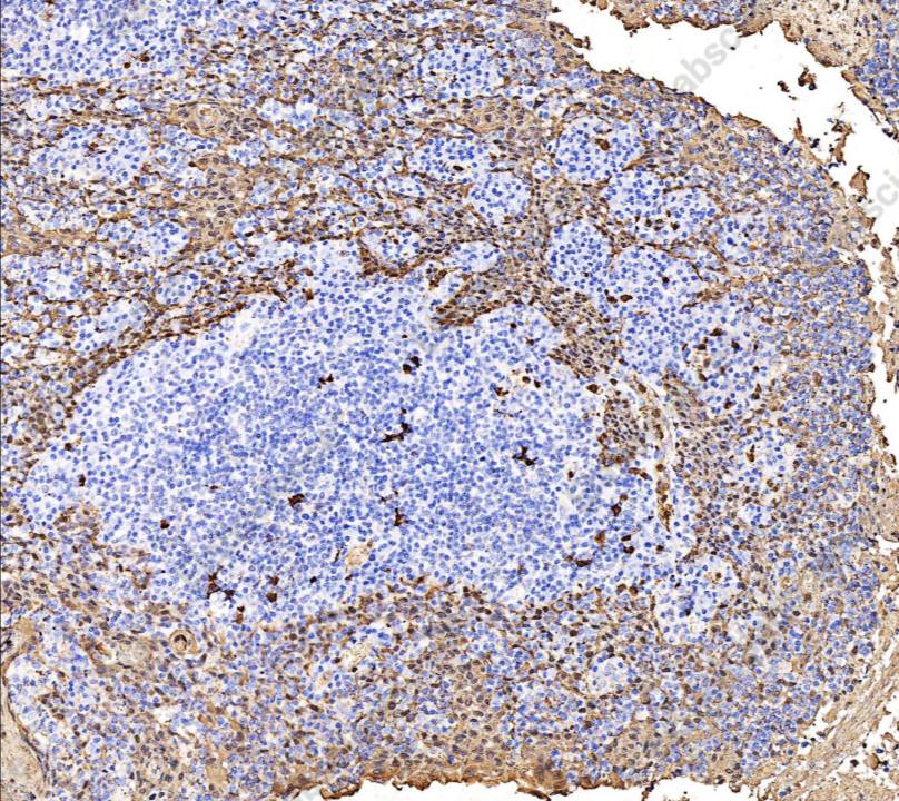 Recombinant S100A8 Monoclonal Antibody - 1