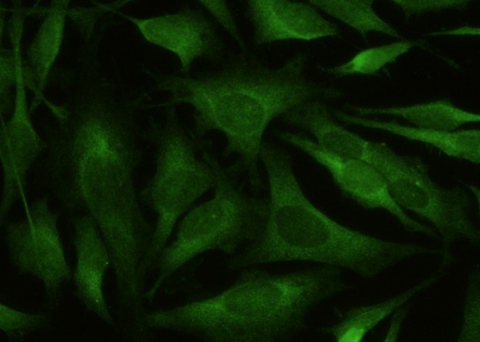Recombinant BACE1 Monoclonal Antibody - small - 2