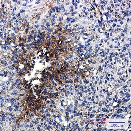 Recombinant beta IV Tubulin Monoclonal Antibody - 5