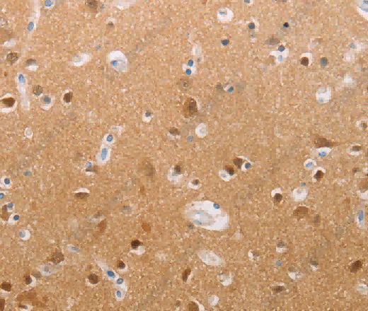PFN2 Polyclonal Antibody - 2