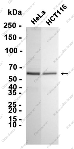 Recombinant PFKFB3 Monoclonal Antibody - 1