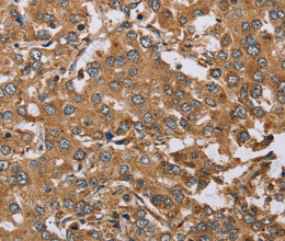 DDAH1 Polyclonal Antibody - 2