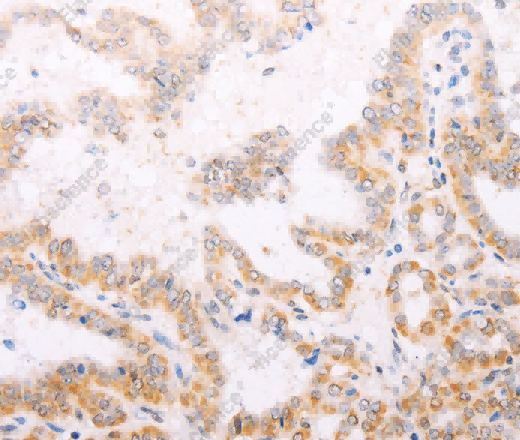 TYR Polyclonal Antibody - 2