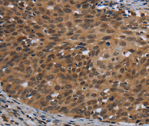 CEBPD Polyclonal Antibody - 2