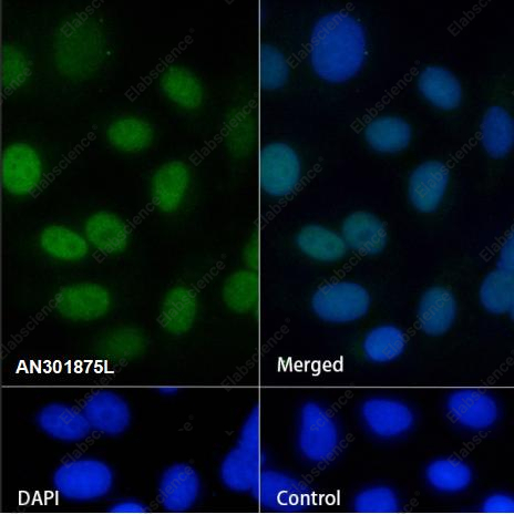 Recombinant Glutathione Peroxidase 4 Monoclonal Antibody - 3