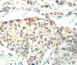 TPM2 Polyclonal Antibody - 3