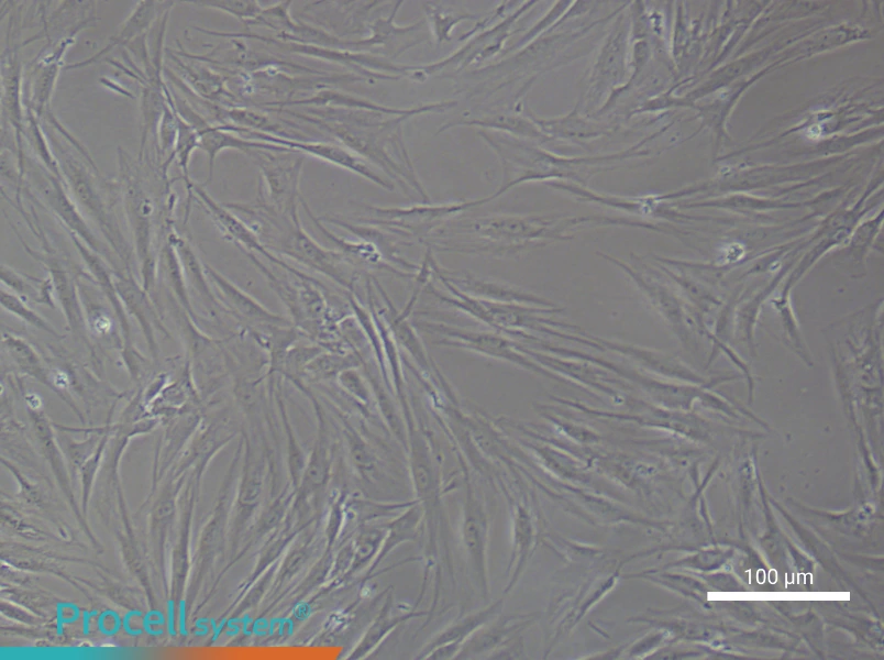 Human Synovial Fibroblast (rheumatoid arthritis) Complete Medium - 1
