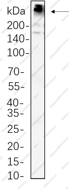 Recombinant Fatty Acid Synthase Monoclonal Antibody - 1