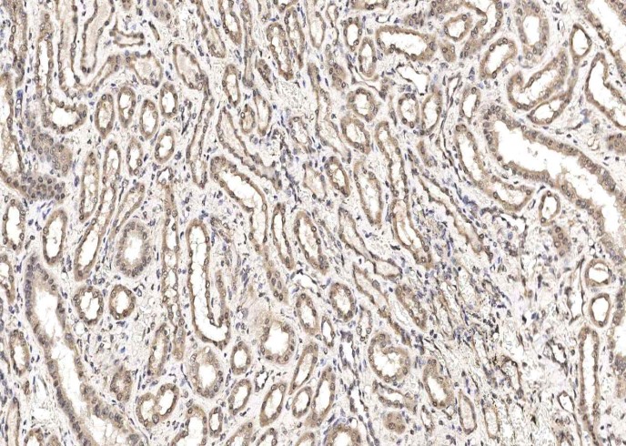 IGSF3 Monoclonal Antibody - small - 2