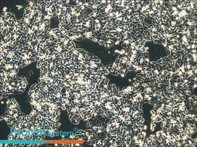 SK-CO-1 Cell Complete MediumSK-CO-1 Cell Complete Medium - 2