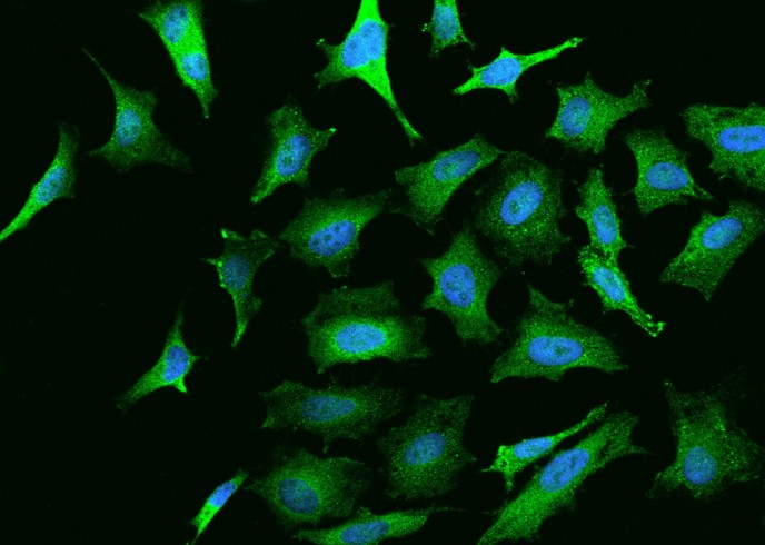 Recombinant NGFR Monoclonal Antibody-searchlist-1