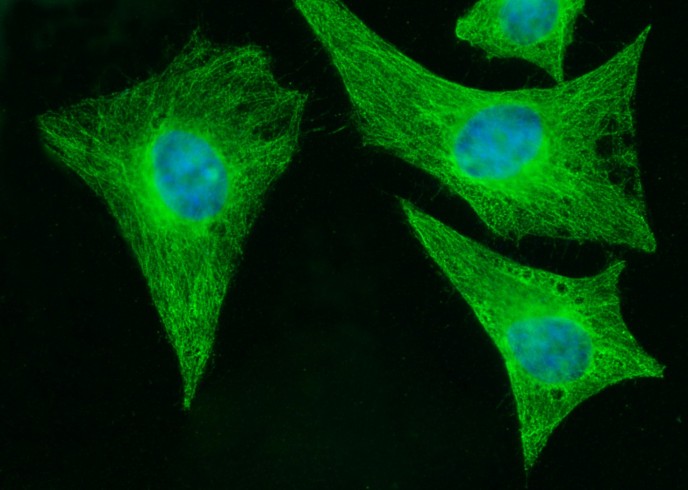 MOB1B/MOBKL1A Monoclonal Antibody-searchlist-1