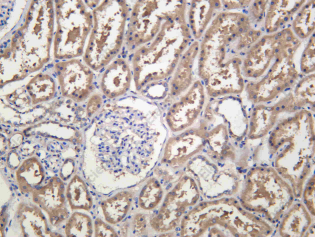 Recombinant RAB9A Monoclonal Antibody - 1
