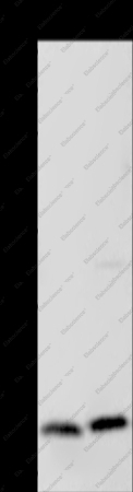 MCTS1 Polyclonal Antibody - 1