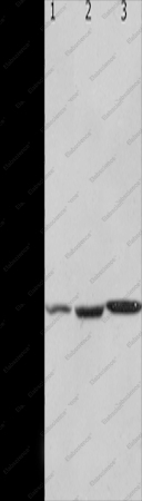 HCRTR2 Polyclonal Antibody - 1