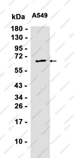 Recombinant RPA70 Monoclonal Antibody - 2