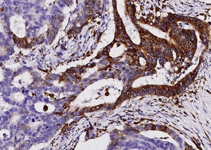 CD74 Monoclonal Antibody - small - 3