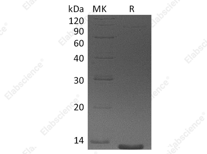 Recombinant Human Eotaxin-3/CCL26 Protein (aa 24-94) - 1